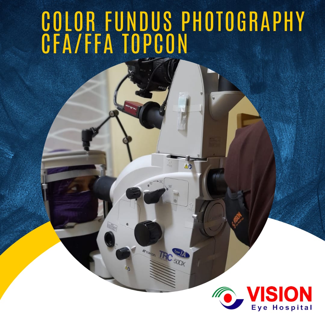 Color Fundus Photography CFA/FFA Topcon