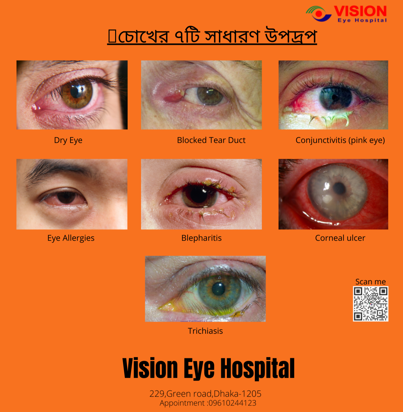 7️⃣ common eye irritation
