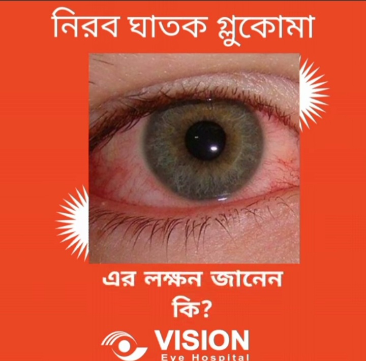 গ্লুকোমা এর লক্ষন জানেন কি??