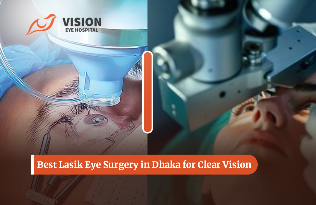 Best Lasik Eye Surgery in Dhaka for Clear Vision