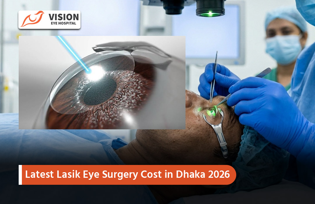 Latest Lasik Eye Surgery Cost in Dhaka 2026