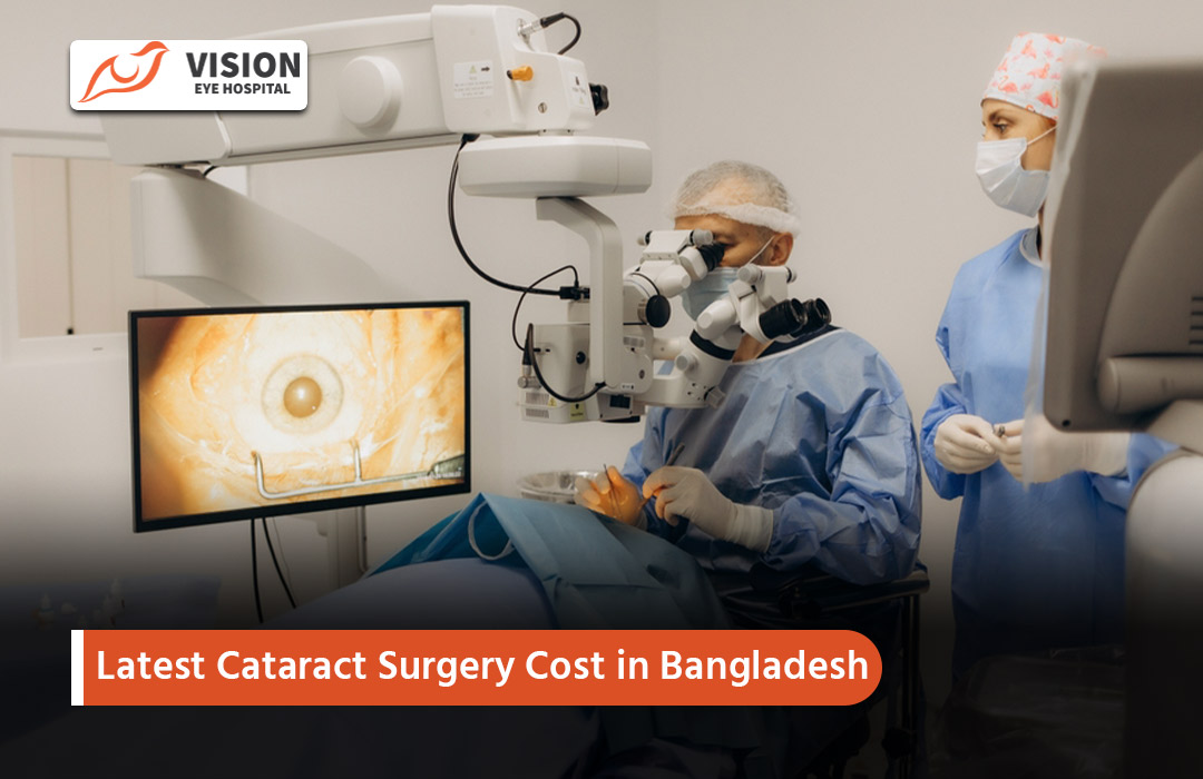 Latest Cataract Surgery Cost in Bangladesh