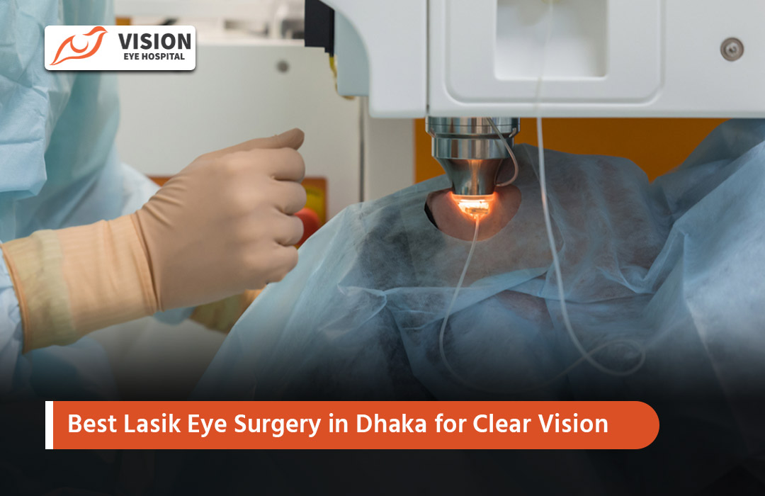 Best Lasik Eye Surgery in Dhaka for Clear Vision