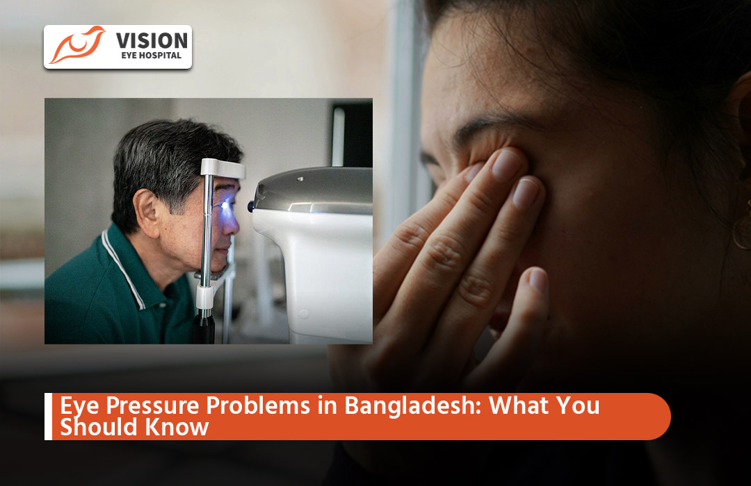 Eye Pressure Problems in Bangladesh: What You Should Know