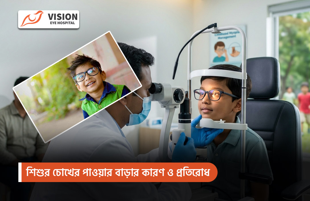 শিশুর চোখের পাওয়ার বাড়ার কারণ ও প্রতিরোধ